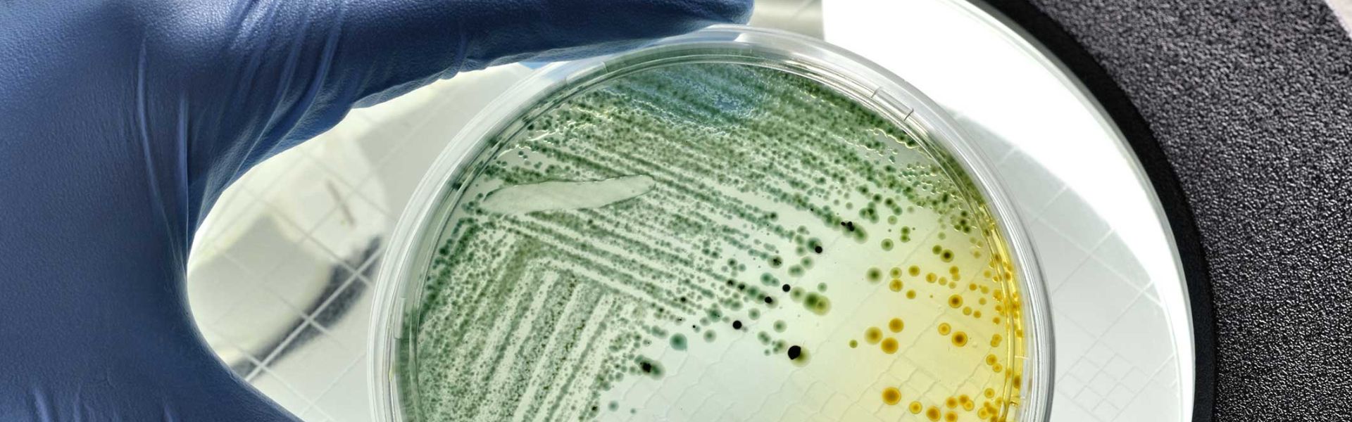 Aliments contaminés par la bactérie E. coli : quels effets sur la santé et comment prévenir les infections ?
